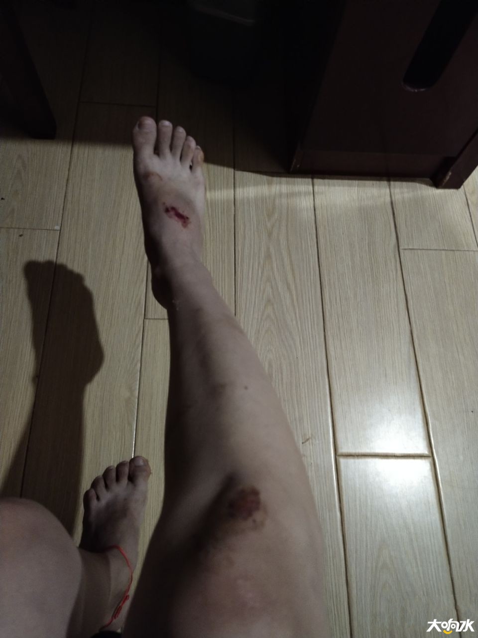 135313baebviexuaca1iol.jpg
